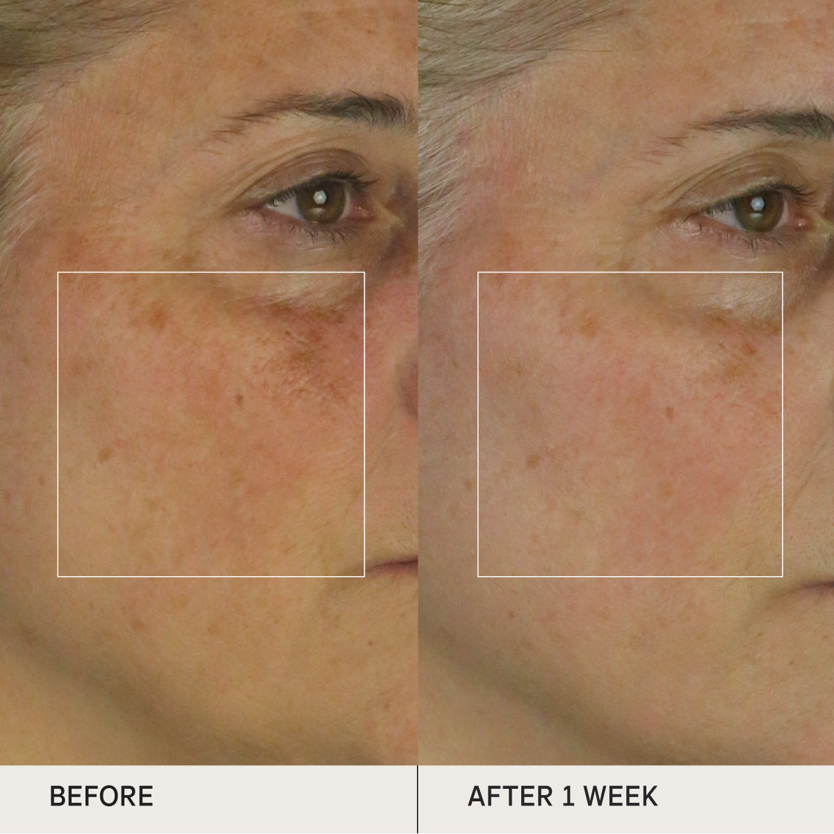 The Brightening Serum